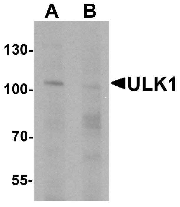 Western blot analysis of ULK1 in rat brain tissue lysate with ULK1 antibody at 1 ug/ml in (A) the absence and (B) the presence of blocking peptide.
