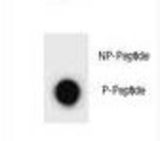 Dot blot of ULK2 Antibody (Phospho S323) Phospho-specific antibody on nitrocellulose membrane. 50ng of Phospho-peptide or Non Phospho-peptide per dot were adsorbed. Antibody working concentrations are 0.6ug per ml.