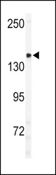 Western blot of ULK2 Antibody in mouse brain tissue lysates (35 ug/lane). ULK2(arrow) was detected using the purified antibody.