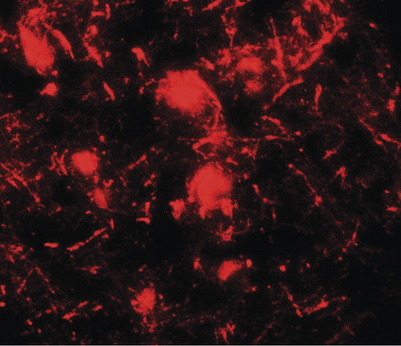 Immunofluorescence of ULK2 in human brain tissue with ULK2 antibody at 20 ug/ml.