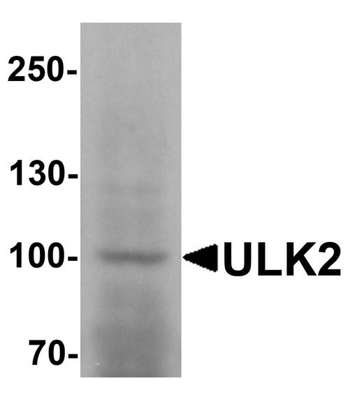 Western blot analysis of ULK2 in human brain tissue lysate with ULK2 antibody at 1 ug/ml.