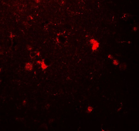 Immunofluorescence of ULK3 in human brain tissue with ULK3 antibody at 20 µg/mL.