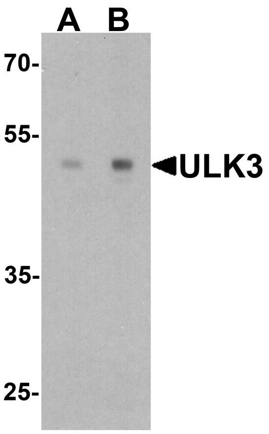 Western blot analysis of ULK3 in human brain tissue lysate with ULK3 antibody at (A) 0.5 and (B) 1 ug/ml.