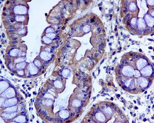 IHC of paraffin-embedded human colon tissue using anti-ULK3 antibody.