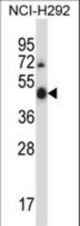 Mouse Ulk3 Antibody western blot of NCI-H292 cell line lysates (35 ug/lane). The Ulk3 antibody detected the Ulk3 protein (arrow).