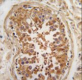 Formalin-fixed and paraffin-embedded human testis tissue reacted with *ULK3 antibody , which was peroxidase-conjugated to the secondary antibody, followed by DAB staining. This data demonstrates the use of this antibody for immunohistochemistry; clinical relevance has not been evaluated.