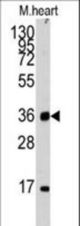 Western blot of anti-ULK3 Antibody in mouse heart tissue lysates (35 ug/lane). ULK3(arrow) was detected using the purified antibody.