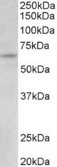 UMOD antibody (0.03 ug/ml) staining of HeLa lysate (35 ug protein in RIPA buffer). Primary incubation was 1 hour. Detected by chemiluminescence.