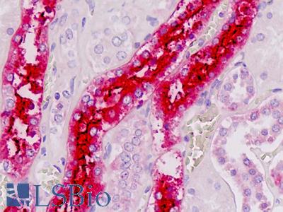 Anti-UMOD / Uromodulin antibody IHC staining of human kidney. Immunohistochemistry of formalin-fixed, paraffin-embedded tissue after heat-induced antigen retrieval.