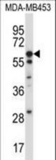 UMOD Antibody western blot of MDA-MB453 cell line lysates (35 ug/lane). The UMOD antibody detected the UMOD protein (arrow).