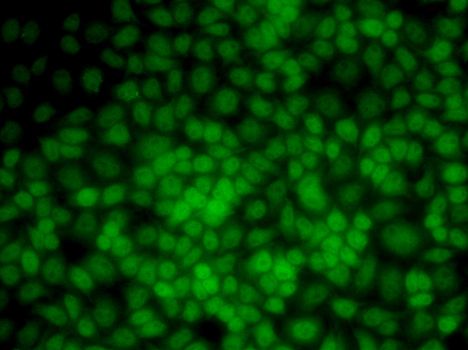 Immunofluorescence blot of HeLa cell using UMPS antibody.