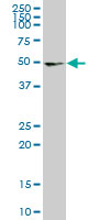 UMPS monoclonal antibody (M06), clone 2B10. Western blot of UMPS expression in IMR-32.
