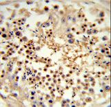 Formalin-fixed and paraffin-embedded human testis tissue reacted with UNC119 Antibody , which was peroxidase-conjugated to the secondary antibody, followed by DAB staining. This data demonstrates the use of this antibody for immunohistochemistry; clinical relevance has not been evaluated.