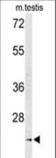 Western blot of UNC119 Antibody in mouse testis tissue lysates (35 ug/lane). UNC119 (arrow) was detected using the purified antibody.