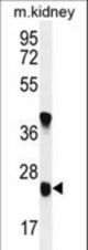 U119B Antibody western blot of mouse kidney tissue lysates (35 ug/lane). The U119B antibody detected the U119B protein (arrow).