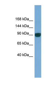 UNC45A antibody LS-C117268 Western blot of Fetal Lung lysate.