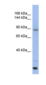 UNC45A antibody LS-C111863 Western blot of Fetal Thymus lysate.
