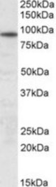 UNC45B antibody (0.3 ug/ml) staining of Human Skeletal Muscle lysate (35 ug protein/ml in RIPA buffer). Primary incubation was 1 hour. Detected by chemiluminescence.