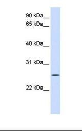 Fetal liver lysate. Antibody concentration: 1.0 ug/ml. Gel concentration: 12%.