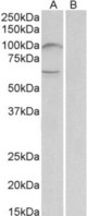 UNC5B antibody (2 ug/ml) staining of Human Bone Marrow lysate (35 ug protein in RIPA buffer) with (B) and without (A) blocking with the immunizing peptide. Primary incubation was 1 hour. Detected by chemiluminescence.