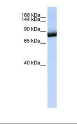 Jurkat cell lysate. Antibody concentration: 1.0 ug/ml. Gel concentration: 6-18%.