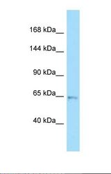 Western blot of Human 293T . UNC5C antibody dilution 1.0 ug/ml.