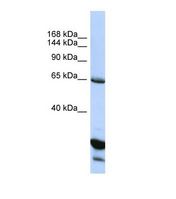 Western blot of Human HepG2. UNC5C antibody dilution 1.0 ug/ml.