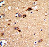 Formalin-fixed and paraffin-embedded human brain tissue with UNC5C Antibody , which was peroxidase-conjugated to the secondary antibody, followed by DAB staining. This data demonstrates the use of this antibody for immunohistochemistry; clinical relevance has not been evaluated.