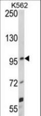 Western blot of UNC5C Antibody in K562 cell line lysates (35 ug/lane). UNC5C (arrow) was detected using the purified antibody.