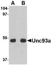 Western blot of Unc93a in HeLa cell lysate with Unc93a antibody at (A) 0.5 and (B) 1 ug/ml.
