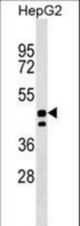 UNC93A Antibody western blot of HepG2 cell line lysates (35 ug/lane). The UNC93A antibody detected the UNC93A protein (arrow).