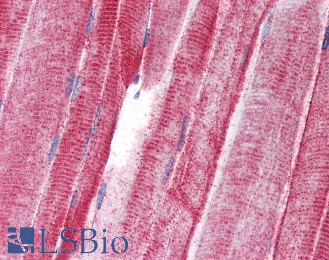 Anti-UNC93B1 / UNC93B antibody IHC of human skeletal muscle. Immunohistochemistry of formalin-fixed, paraffin-embedded tissue after heat-induced antigen retrieval. Antibody LS-B2711 concentration 5 ug/ml.