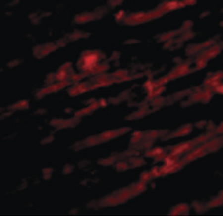 Immunofluorescence of Unc93b in Human Heart cells with Unc93b antibody at 20 ug/ml.