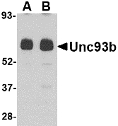 Western blot of Unc93b in human heart tissue lysate with Unc93b antibody at (A) 0.5 and (B) 1 ug/ml.