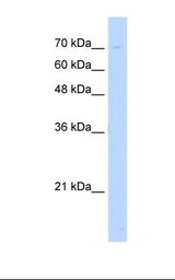 Jurkat cell lysate. Antibody concentration: 5.0 ug/ml. Gel concentration: 12%.