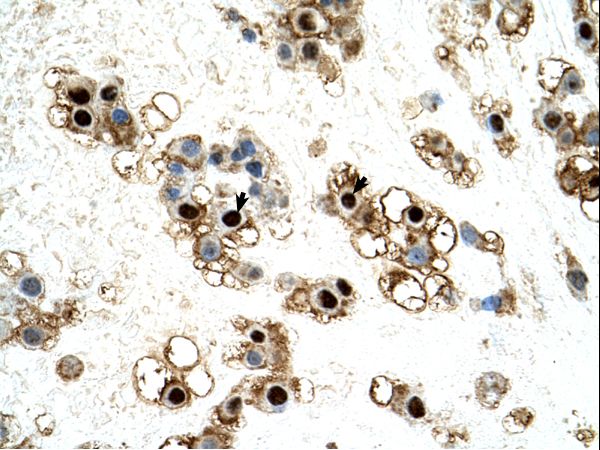 UNCX antibody LS-C82815 was used in IHC to stain formalin-fixed, paraffin-embedded human placenta.