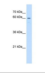 Jurkat cell lysate. Antibody concentration: 1.0 ug/ml. Gel concentration: 12%.