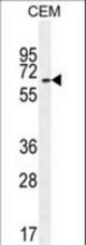 UNCX Antibody western blot of CEM cell line lysates (35 ug/lane). The UNCX antibody detected the UNCX protein (arrow).
