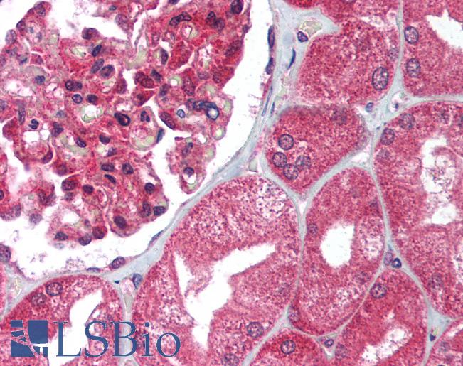 Anti-UNG antibody IHC of human kidney. Immunohistochemistry of formalin-fixed, paraffin-embedded tissue after heat-induced antigen retrieval. Antibody LS-B1434 concentration 5 ug/ml.