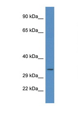 UNG antibody LS-C145394 Western blot of HeLa Cell lysate. Antibody concentration 1 ug/ml.
