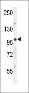 UNK Antibody western blot of mouse lung tissue lysates (35 ug/lane). The UNK antibody detected the UNK protein (arrow).