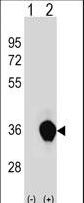 Western blot of UNKL (arrow) using rabbit polyclonal UNKL Antibody. 293 cell lysates (2 ug/lane) either nontransfected (Lane 1) or transiently transfected (Lane 2) with the UNKL gene.