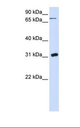 293T cell lysate. Antibody concentration: 1.0 ug/ml. Gel concentration: 12%.