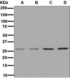 Western blot analysis on (A) 293T, (B) HeLa, (C) HCT-116, and (D) fetal kidney lysates using anti-UPP1 antibody.