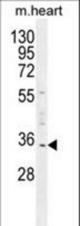 UPP2 Antibody western blot of mouse heart tissue lysates (35 ug/lane). The UPP2 antibody detected the UPP2 protein (arrow).