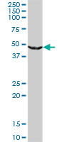 UPB1 monoclonal antibody (M09), clone 3F12. Western blot of UPB1 expression in Jurkat.