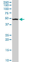 UPB1 monoclonal antibody (M09), clone 3F12. Western blot of UPB1 expression in human liver.