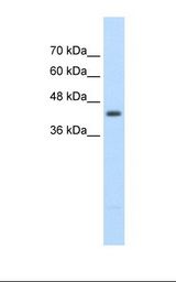Jurkat cell lysate. Antibody concentration: 2.5 ug/ml. Gel concentration: 12%.
