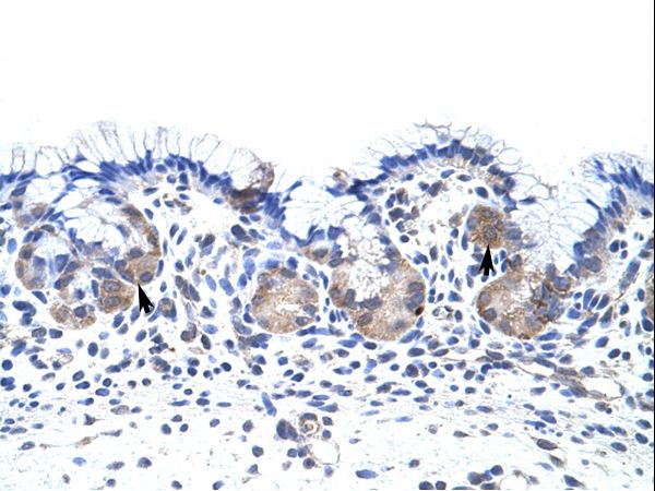 UPF3B antibody LS-C31657 was used in IHC to stain formalin-fixed, paraffin-embedded human stomach.