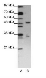 A: Marker, B: Jurkat Cell Lysate